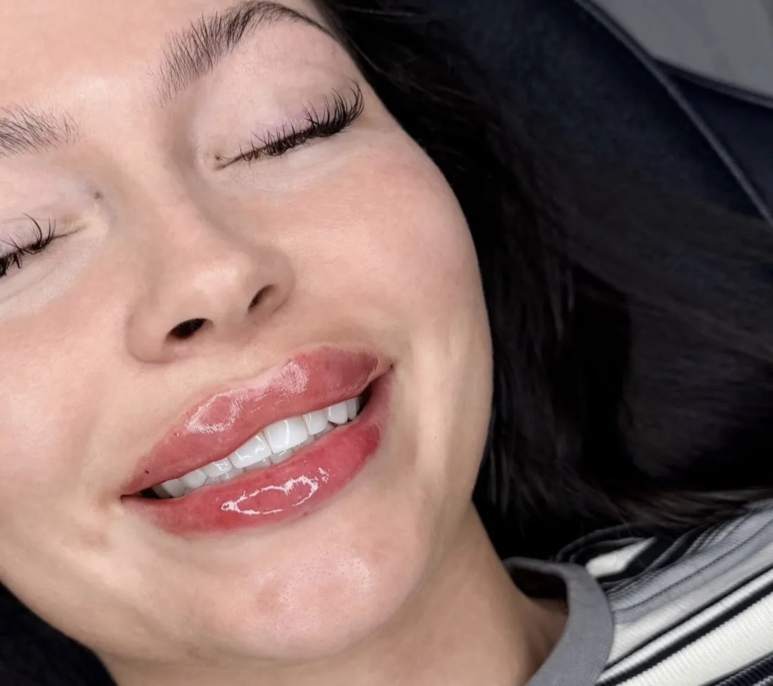 A smiling client with freshly treated, glossy lips