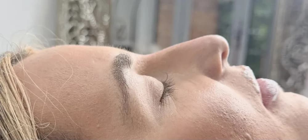 A client's nose in profile before and after non surgical rhinoplasty: before