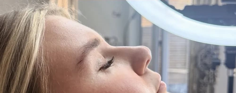A client's profile before and after a nose tip lift: after