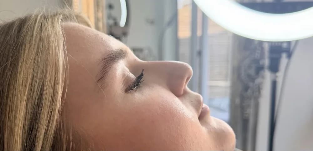 A client's profile before and after a nose tip lift: before